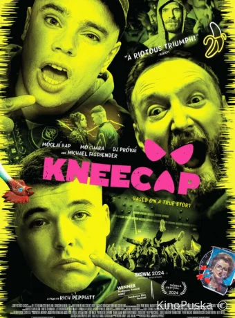 Коленная чашечка / Kneecap 2024 смотреть онлайн